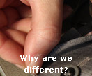 Why are we different?